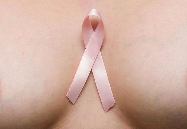 Važni su otkrivanje raka dojke u ranoj fazi i prevencija